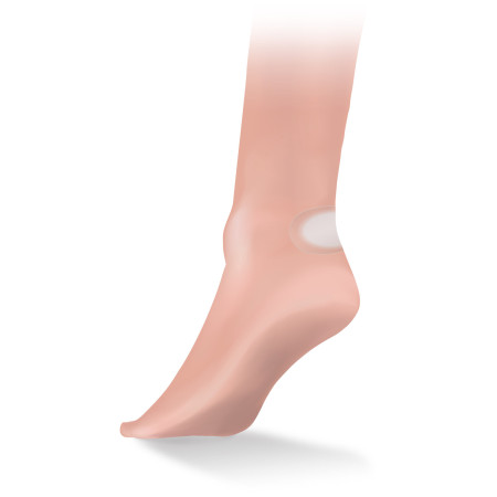 Samolepící náplasti Lifesystems Blister Plasters 6 Pack